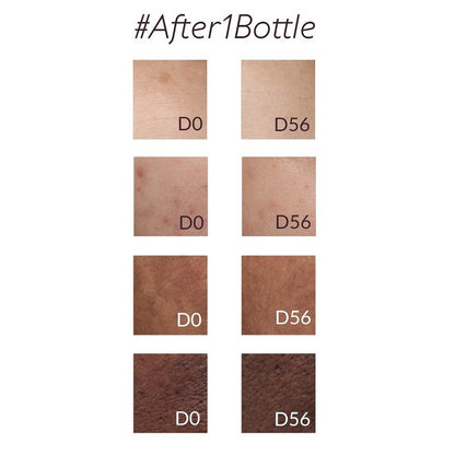 CAUDALIE Vinoperfect Sérum Resplandor Antimanchas 30ml-3